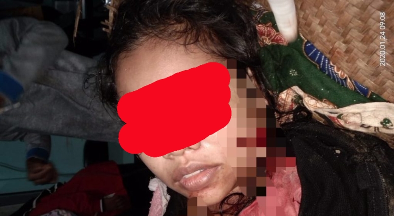 Permintaan Rujuk di Tolak, Suami Bacok Isteri Pakai Mandau di Kapuas
