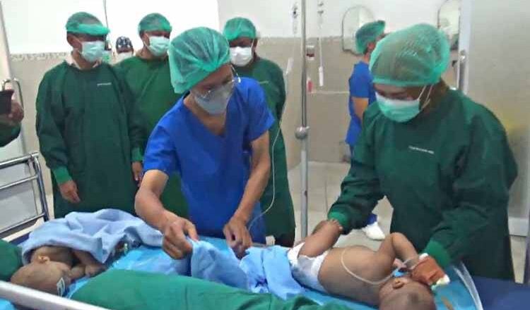 Operasi Bibir Sumbing Gratis untuk Membantu Masyarakat Kurang Mampu