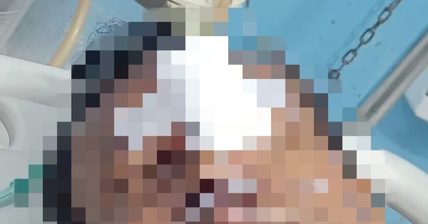 Dugaan Penganiayaan di Kapuas, Pasangan Suami Istri Alami Luka Serius